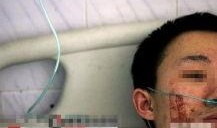 秃头最新爆料,揭秘明星脱发背后的真相